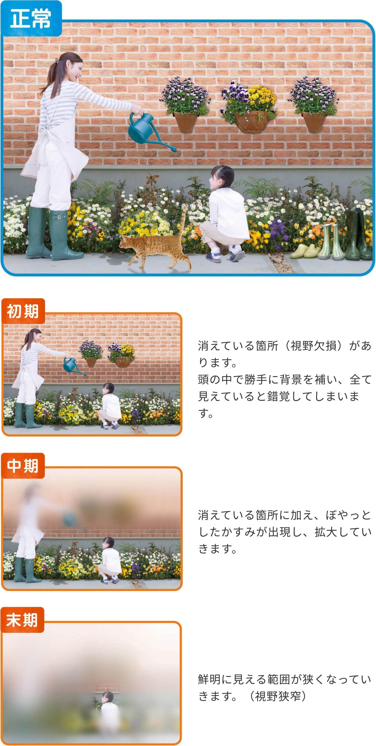 緑内障について