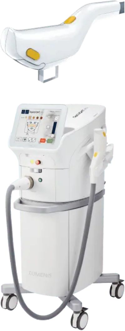 ドライアイの治療方法（IPL）について